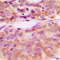 Anti-c-SRC (pY529) Antibody